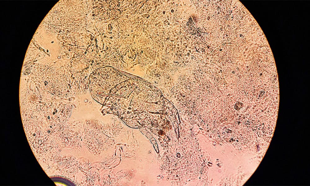 bird mite specimen